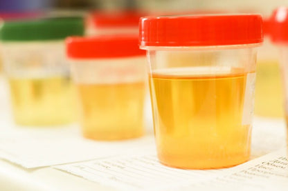 Do At Home Urine Alcohol Test