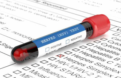 Herpes Screening
